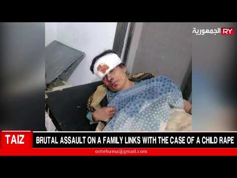TAIZ : BRUTAL ASSAULT ON A FAMILY LINKS WITH THE CASE OF A CHILD RAPE